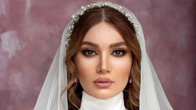  تغییرات چهره متین ستوده قبل و بعد از طلاق / با کامران جوانتر و خوشگلتر شد !