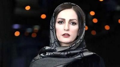  عکس قبل و بعد از شقایق دهقان / در ۲۲ سالگی با طراوت تر از الان !