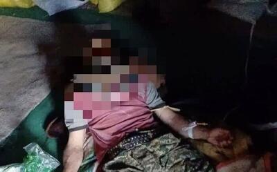  حمله دردناک خرس به یک کوهنورد