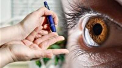  از هر پنج بیمار دیابتی، یک نفر دچار عوارض چشمی می‌شود