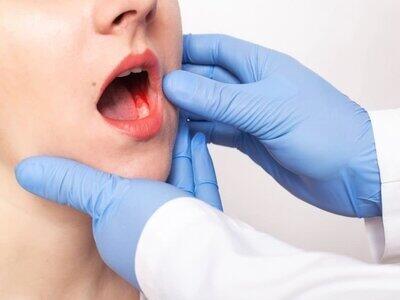  اصلی‌ترین عوامل خطر در سرطان دهان چیست؟