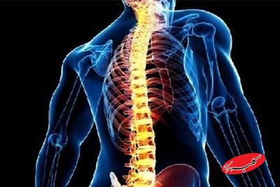  افزایش درد و مشکلات ستون فقرات در نسل جوان - کلبه سرگرمی