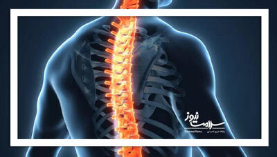  افزایش مشکلات ستون فقرات در نسل جوان: خطرات و روش‌های درمان نوین