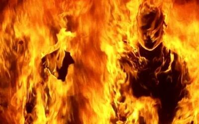  وضعیت وخیم «احمد» در بیمارستان سوختگی اهواز