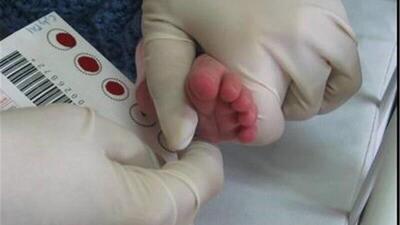  تداوم موفقیت برنامه ملی غربالگری نوزادان با پوشش بیش از ۹۹ درصد