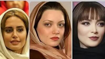  چهره باورنکردنی بازیگران زن بعد از عمل زیبایی؛ سحر دولتشاهی تا نیوشا ضیغمی بی‌نظیر شدند!