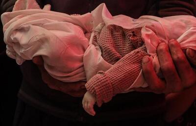  راز دردناک در مورد شهادت کودکان غزه/ چرا هیچ علایمی بر روی پیکر برخی از کودکان غزه وجود ندارد؟