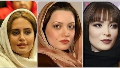  تغییر چهره عجیب بازیگران زن ایرانی بعد از عمل‌های زیبایی؛ از سحر دولتشاهی تا نیوشا ضیغمی!