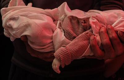  کاربرد تسلیحات مرموز در غزه؛ شهادت کودکان بدون آثار جراحت ظاهری