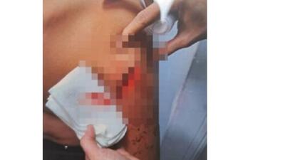  زنگ خطر حمل چاقو در مدرسه؛ دانش آموز خمامی مجروح شد