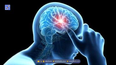  پیری زودرس مغز در کمین این افراد است