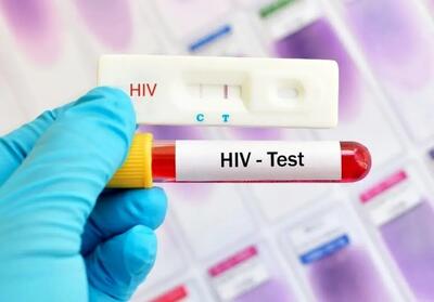  آغاز پویش «من هم تست HIV می‌دهم» از امروز تا ۲۰ آذرماه