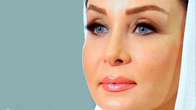  تغییر چهره حدیث فولادوند؛ بازیگری که دیگر شبیه گذشته‌اش نیست!
