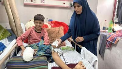  وزارت بهداشت غزه: ۶ هزار نفر با حملات اسرائیل قطع عضو شدند