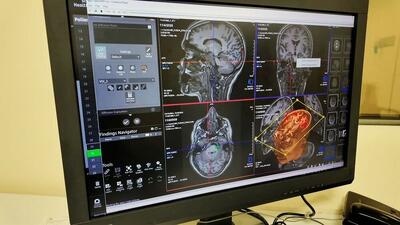  تجهیز نرم افزارهای پیشرفته واحد MRI بیمارستان سینا به همت خانواده یک خیر سلامت