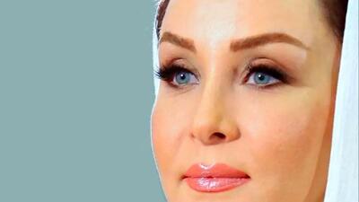  حدیث فولادوند با تغییر چهره جدید؛ بازیگری که دیگر شبیه گذشته نیست