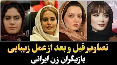  فیلم / تعییر چهره باورنکردنی و حیرت انگیز خانم بازیگران پس از دستکاری صورتشان / از الناز حبیبی تا طناز طباطبایی از سحر دولتشاهی تا نیوشا ضیغمی و ...