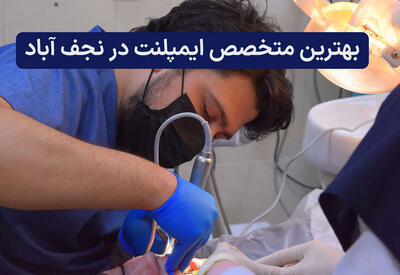  لیست ۱۰ نفر از بهترین متخصصان ایمپلنت در نجف آباد