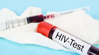  آغاز پویش «من هم تست HIV می‌دهم» از امروز تا ۲۰ آذرماه