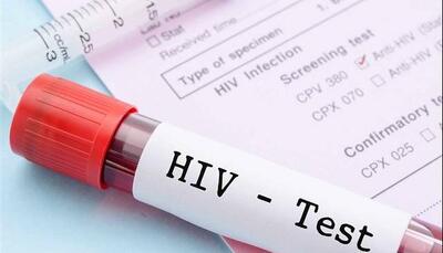  آخرین وضعیت واکسن HIV / انگ اجتماعی بزرگ‌ترین مانع در کنترل این بیماری