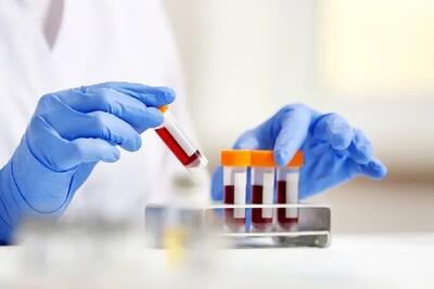  غربالگری کلسترول کودکان ضروری است؟
