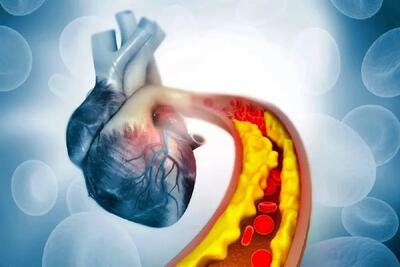  پایان قرص های استاتین‌؟ ژن‌درمانی جدید چربی خون را ریشه‌کن می‌کند!