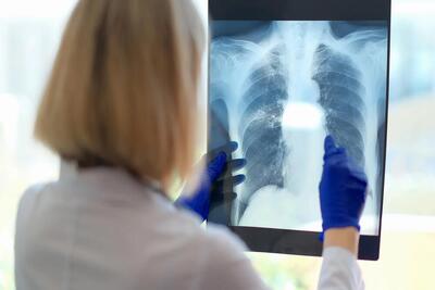  یک مشکل پنهان تنفسی ممکن است دلیل خستگی مزمن باشد