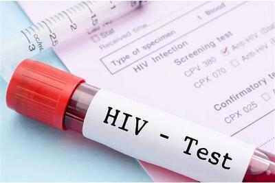  آخرین وضعیت واکسن HIV / انگ اجتماعی بزرگ ترین مانع در کنترل این بیماری