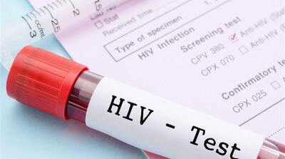  آخرین وضعیت واکسن HIV - مردم سالاری آنلاین