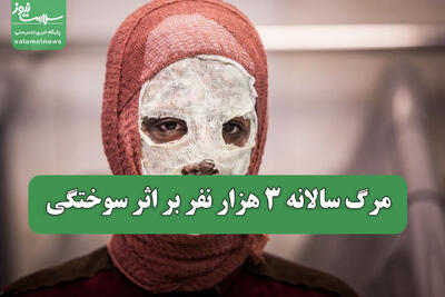  مرگ سالانه 3 هزار نفر بر اثر سوختگی