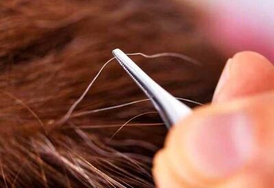  آیا می‌توان جلوی سفید شدن موها را گرفت؟