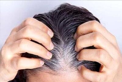  آیا می‌توان جلوی سفید شدن موها را گرفت؟