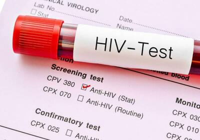  انگ اجتماعی بزرگ‌ترین مانع در کنترل HIV/اهمیت دسترسی به ابزار پیشگیری
