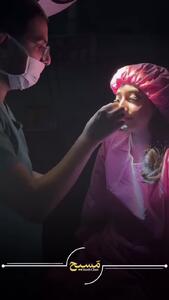  عمل انحراف بینی در کلینیک مسیح