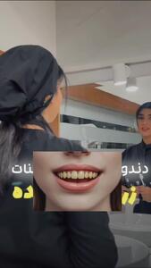  دلایل زردی دندونات رو بشناس!
