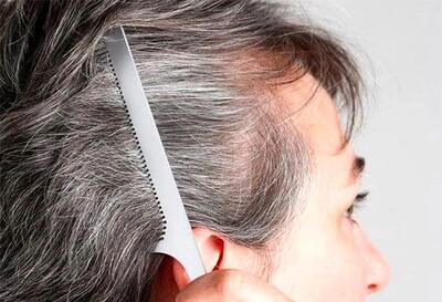  راهکارهای کاهش سفیدی مو