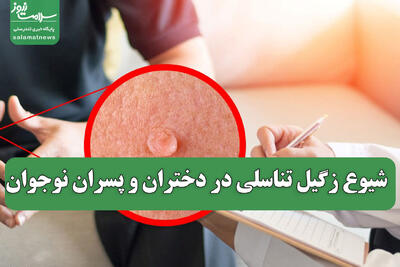  شیوع زگیل تناسلی در دختران و پسران نوجوان