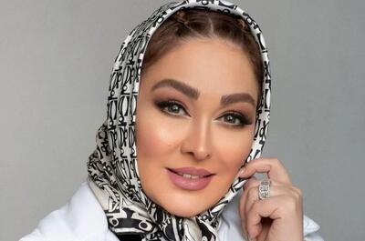  عکسی رو شده از چهره باورنکردنی الهام حمیدی قبل از عمل زیبایی
