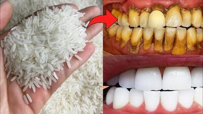  جرمگیری دندان با برنج؟ ترفند عجیب اما واقعی!