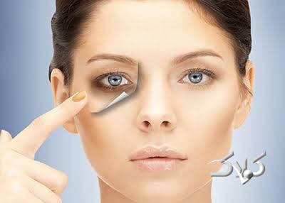  رفع گودی زیر چشم در خانه: راهکارهای ساده و مؤثر - مجله اینترنتی کولاک