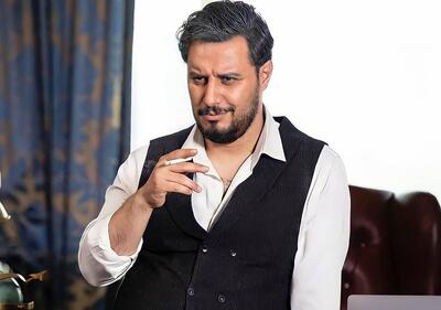  جواد عزتی پس از زخم کاری پیر و کچل شد!/ عکس