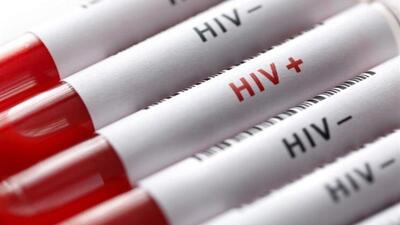  «مصرف تفننی مواد» و «رفتارهای جنسی پرخطر» عامل اصلی افزایش ریسک HIV