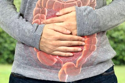  غذاهای آماده عامل کاهش سن ابتلا به سرطان روده؟