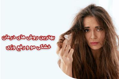  بهترین روش های درمان خشکی مو و رفع وزی