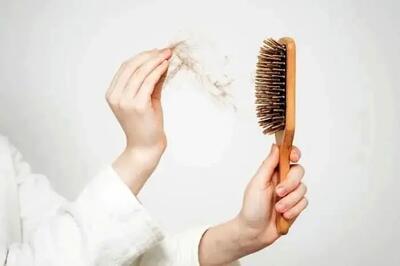  چرا فصل سرما ریزش مو را تشدید می‌کند؟