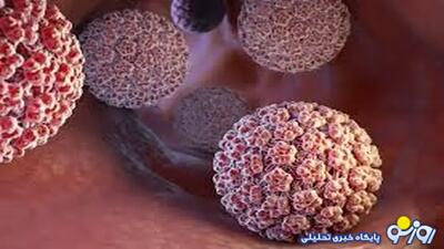  زگیل تناسلی در بچه مدرسه‌ای‌ها!