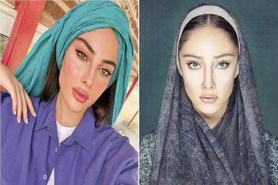 دنیای بازیگران؛ انگلیسی صحبت کردن ترلان پروانه/ مجری چشاش ورقلمبید چقد روونه