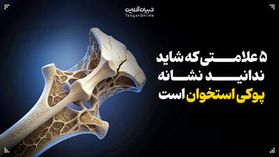  ۵ علامتی که شاید ندانید نشانه پوکی استخوان است