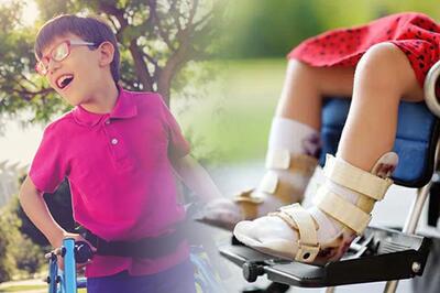  معجزه سلول‌درمانی برای کودکان فلج مغزی