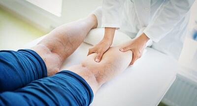  با چند عادت ساده از ابتلا به واریس پیشگیری کنیم + عوامل موثر در بروز واریس